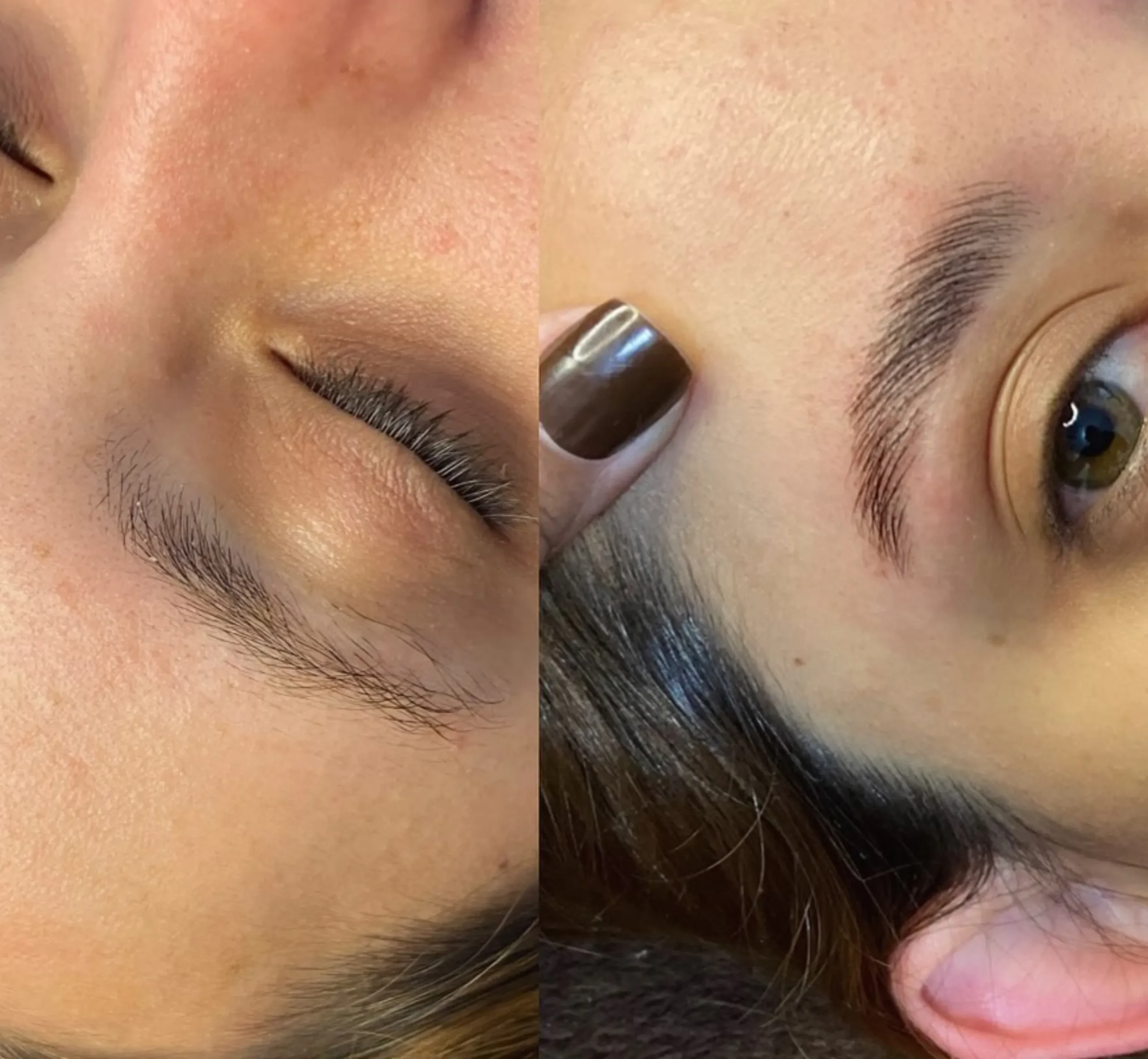 does tattoo stop hair growth