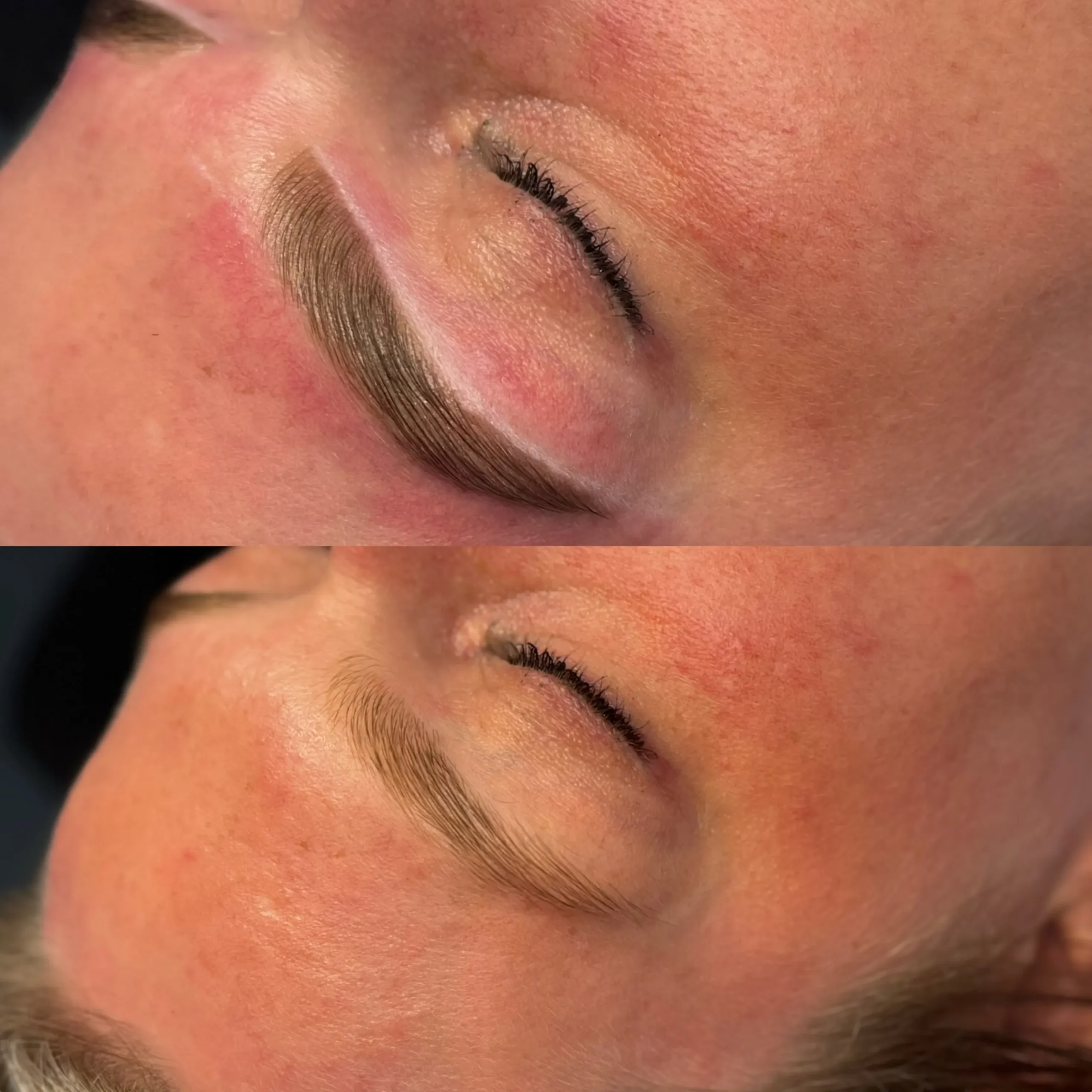 tattooing vs hair follicles